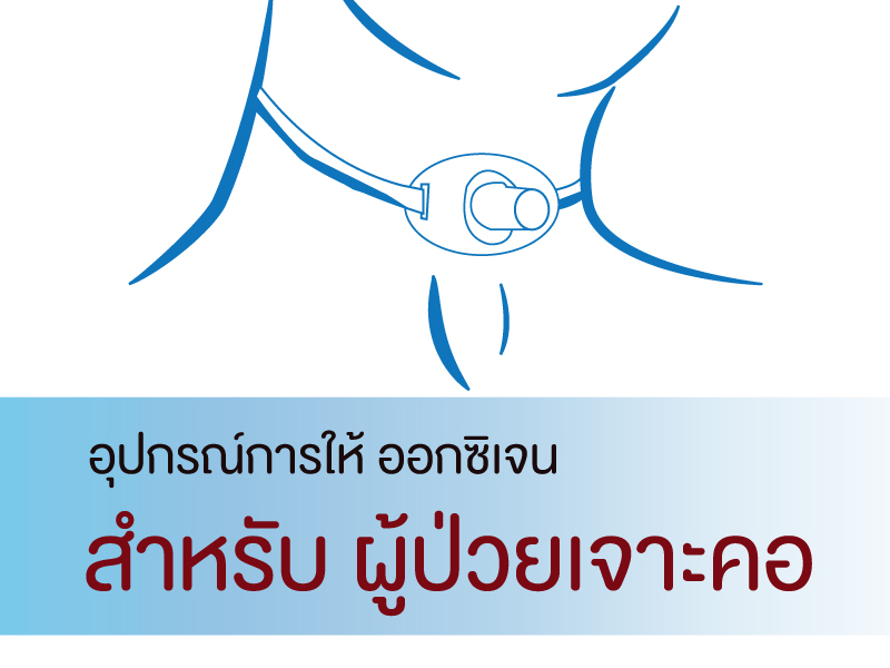 อุปกรณ์การให้ออกซิเจน สำหรับผู้ป่วยเจาะคอ